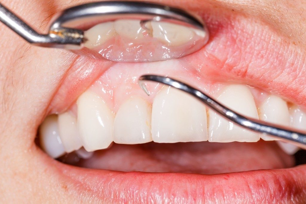 Close up dental examination
